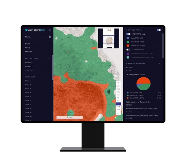 AI 기반 병리분석 솔루션 '루닛 스코프 PD-L1' [사진=루닛]