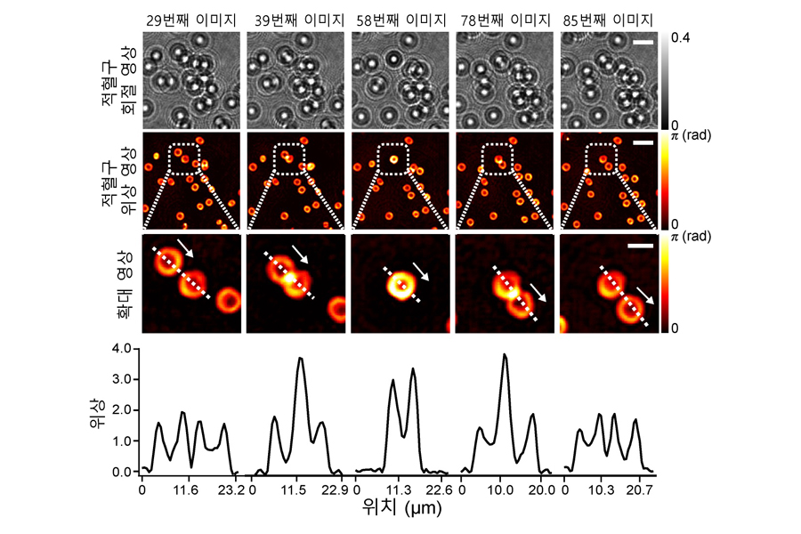 빠르게 흘러가는 적혈구의 실시간 위상 영상 복원 결과. 이 기술을 활용해 빠르게 움직이는 적혈구의 영상을 높은 해상도로 복원할 수 있다. [사진=KAIST]