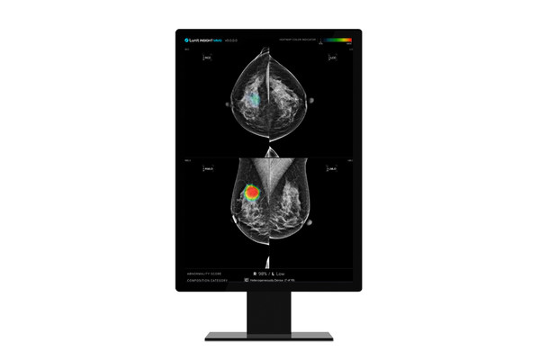 루닛 유방촬영술 AI 영상분석 솔루션 '루닛 인사이트 MMG' [사진=루닛]