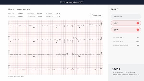 뷰노메드 딥ECG 운영화면 [사진=뷰노]