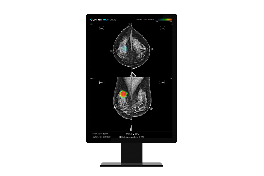 루닛 유방촬영술 AI 영상분석 솔루션 '루닛 인사이트 MMG' [사진=루닛]