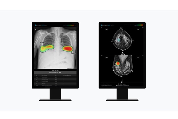 (왼쪽부터) 흉부 엑스레이 AI 영상분석 솔루션 '루닛 인사이트 CXR', 유방촬영술 AI 영상분석 솔루션 '루닛 인사이트 MMG' [사진=루닛]
