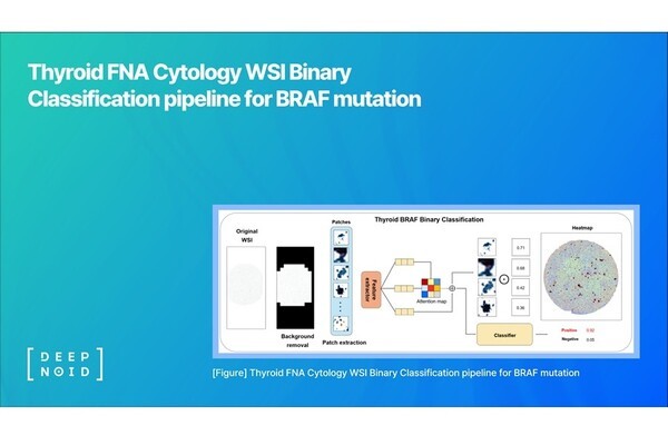 딥노이드, 갑상선 세포검사 AI 연구성과 공개